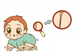 全自动母乳分析仪婴幼儿肥胖的重要原因是什么？
